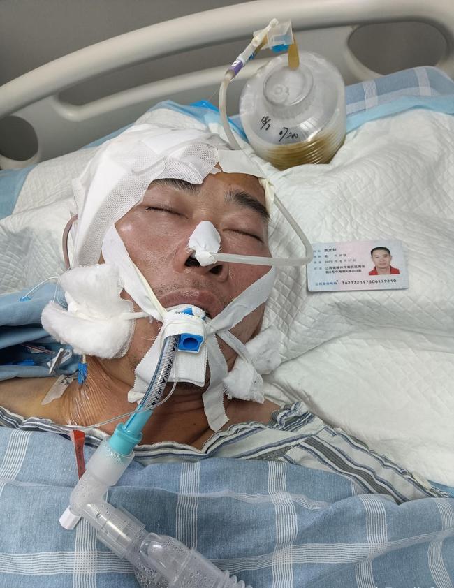男子酒足饭饱后突发脑干出血，一场与时间赛跑的ICU之战
